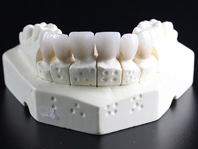 teeth molding teeth mold for implants 